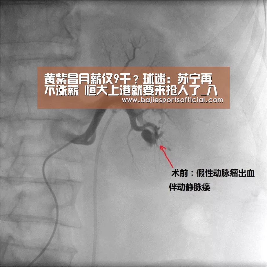 黄紫昌月薪仅9千?球迷:苏宁再不涨薪 恒大上港就要来抢人了_八戒体育直播(图4) 八戒体育官网